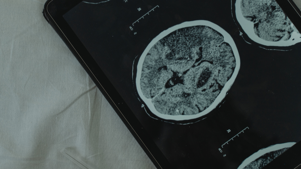 Lexique neuro atypies